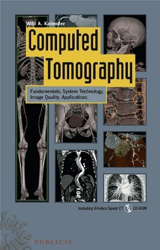COMPUTED TOMOGRAPHY FOR TECHNOLOGISTS 2ND EDITION PDF FREE visual data 6