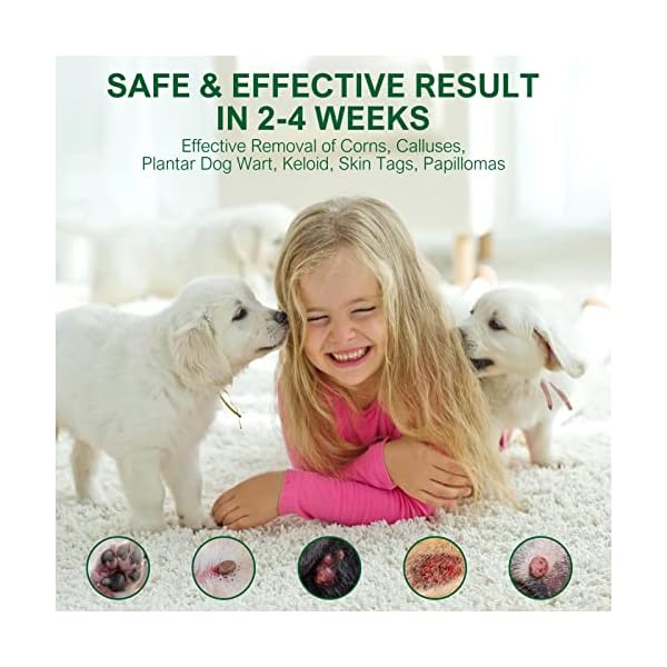 Dog-Wart-Remover-Natural-Dog-Wart-Removal-Treatment-Skin-Tag-Remover-Rapidly-Eliminates-Pets-Warts-Harmless-Pain-Free-No-Irritation-Effective-Skin-Tag-Removal Natural Dog Wart Remover - Rapid Elimination Solution | Safe & Effective