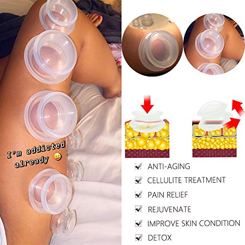 4 Sizes Cupping Therapy Set-Professional Cupping Therapy Studio And Household Silicone Cupping Set, Stronger Suction, Suitable For Myofascial Massage, Muscle, Nerve, Joint Pain #TOP2