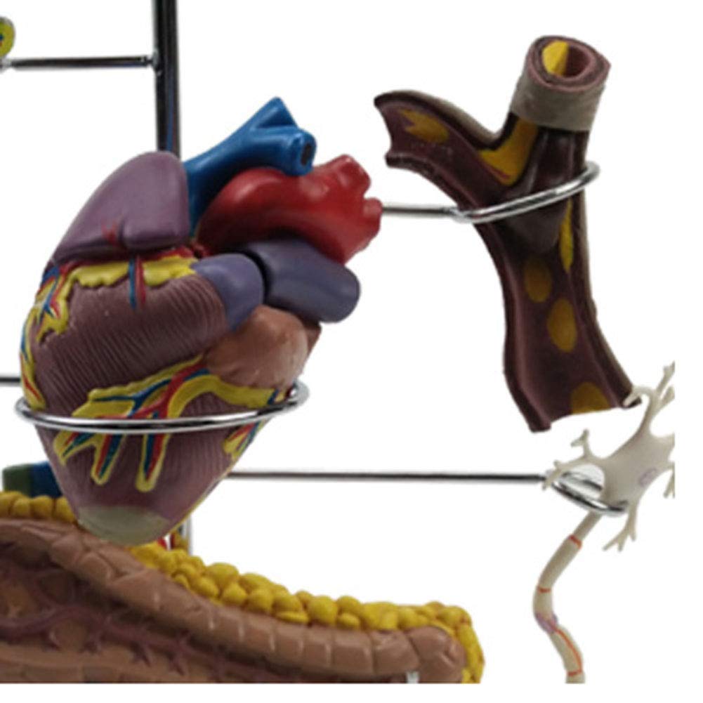 Cukrzyca Dla Lekarzy Biuro Narzędzie Edukacyjne Anatomia Człowieka Zestaw Modeli Cukrzycy 8-Częściowy Zawiera Stojak Do Wyświetlania - Podręcznik Medyczny