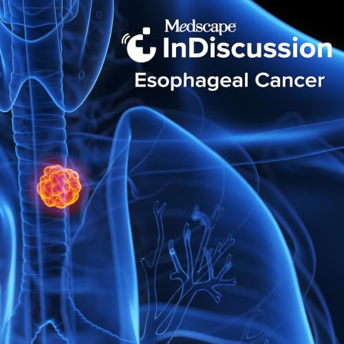 『Medscape InDiscussion: Esophageal Cancer』のカバーアート