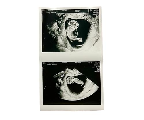 Personalized Pregnancy Prank Ultrasound Photos | Customized Ultrasound Positive Test