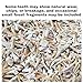 100 Real Fossilized Shark Teeth – Authentic Prehistoric Fossils with Acrylic Display Box – Geology & Science Collectors – Fossil King