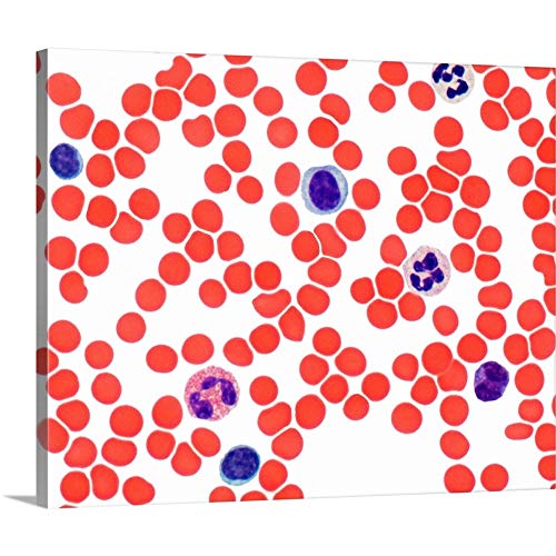 GREATBIGCANVAS Blood Smear, Light Micrograph Canvas Wall Art Print, Home Decor Artwork, 30