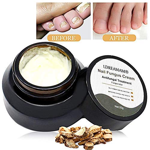 Nail Fungus Cream,Fungus Stop,Foot Fungus,Anti fungal Nail,Fungus Treatment Cream,Foot & Nail Fungus Treatment,Effective Against Nail Fungus,Repair and Protect Nails (20g) - Thumbnail 6