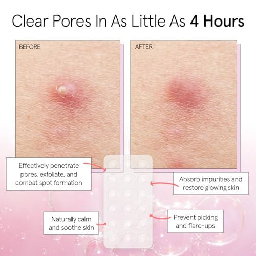 grace & stella Award Winning Invisible Skin Rescue Covers with Hydrocolloid (Round, 36 Count) - With Salicylic Acid and Tea Tree for Absorbing Impurities - Dermatologist Tested Skin Care, Cruelty Free, Vegan - Image 4