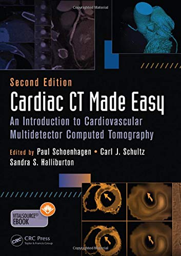 Cardiac CT Made Easy: An Introduction to Cardiovascular Multidetector Computed Tomography, Second Edition