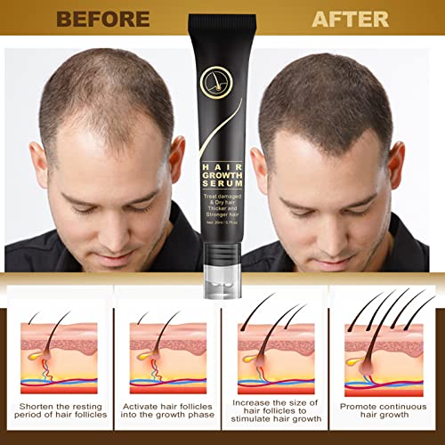 Organic Hair Serum Roller, Regrowth Hair Serum Roller, Triple Roll-On Massager Hair Growth Essence,