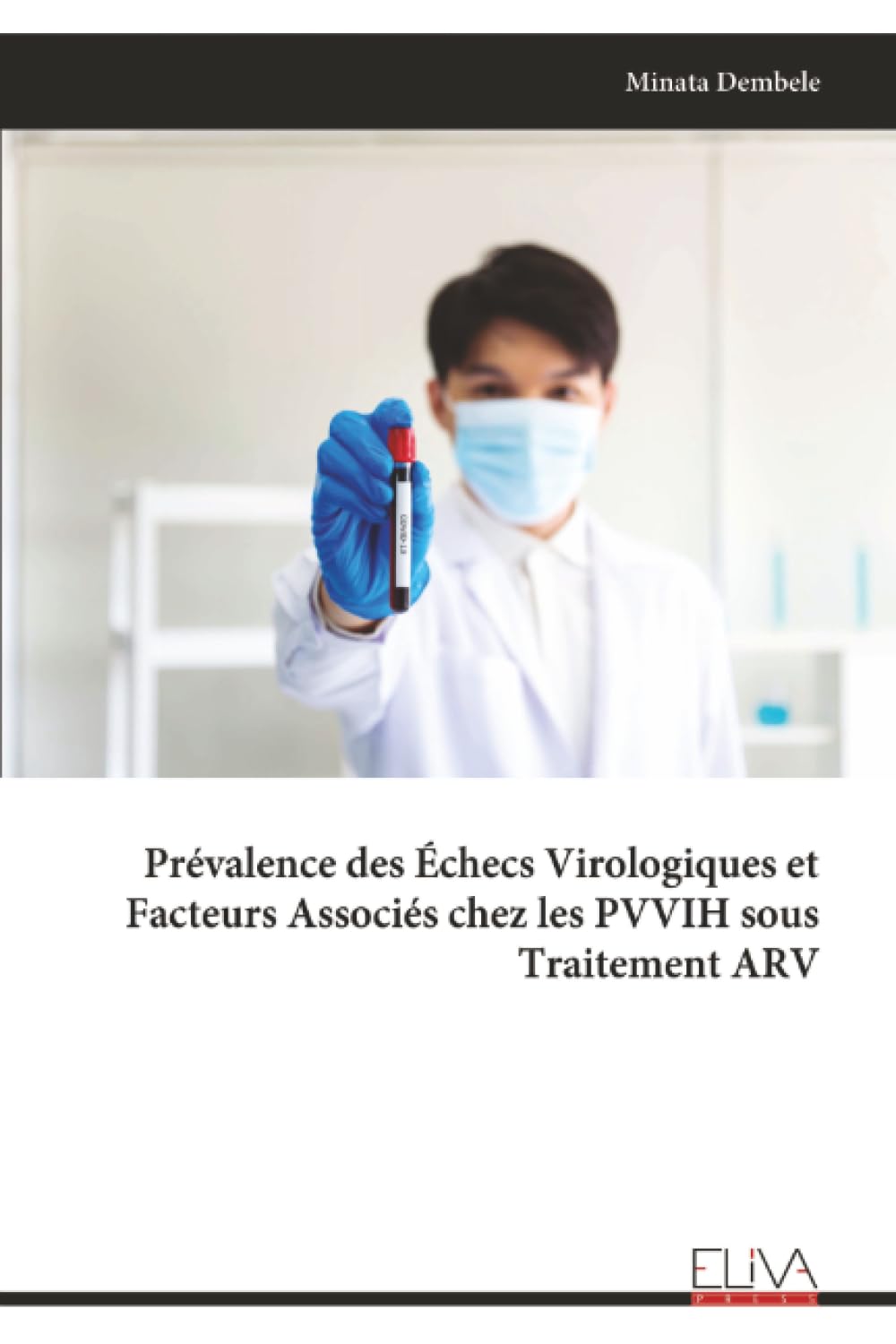 Prévalence des Échecs Virologiques et Facteurs Associés chez les PVVIH sous Traitement ARV