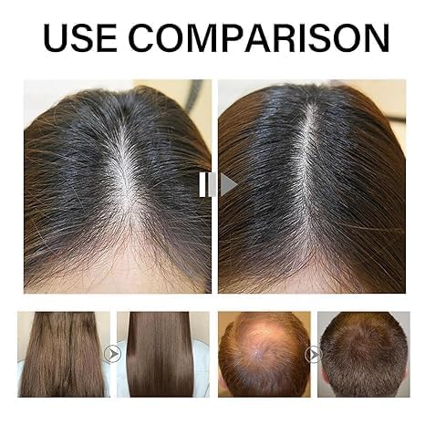 Gel de Azúcar Desoxirribosa para el Crecimiento del Cabello, Esencia para el Engrosamiento del Cabello para Hombres y Mujeres, Suero Reparador Fuerte