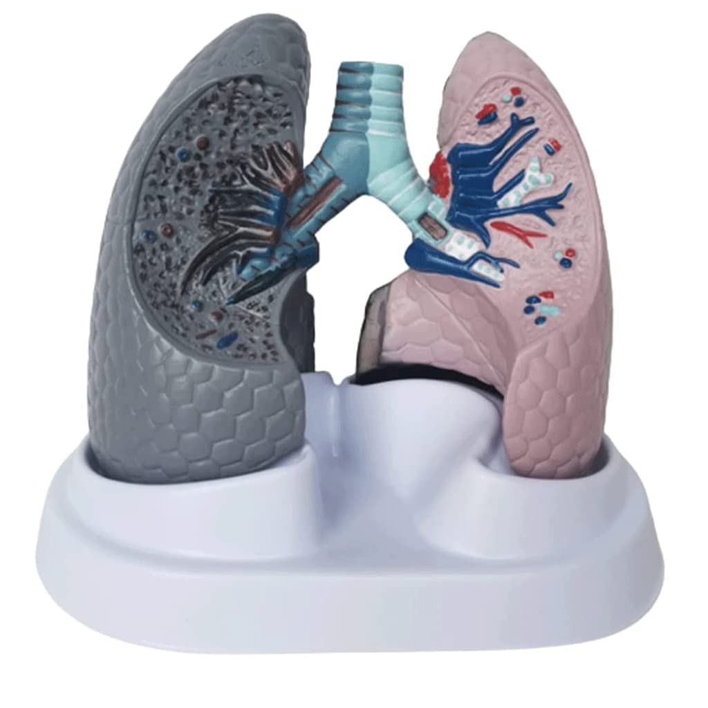 GTHTUHFD Skeleton Model Human Body Model Smoking And Normal Lung Models Human Lung Anatomy Model Medical Human Organ Model For Teaching Study