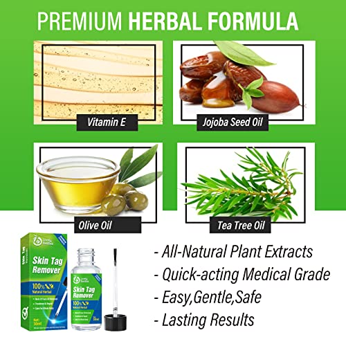 Milia Remover Spot Treatment Helps Skin Dissolve and Reduce with