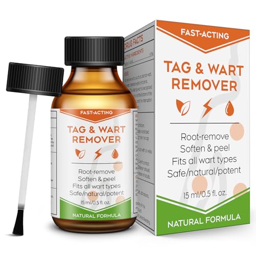 Image of inchSTAY STOKED inch Wart Remover, 15 ml Skin Tag Remover Freeze Off - Plantar Wart Remover for Feet with Salicylic Acid - Best Wart Removal for Common Wart-6SZ