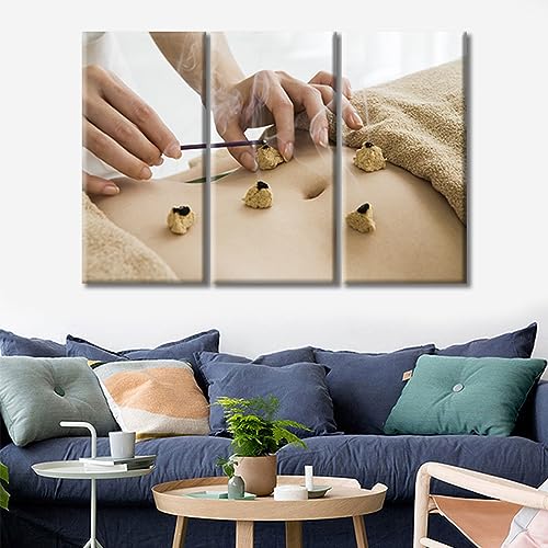 Image of Moxa Moxibustion Prints for Wall Decor Moxibustion Framed Wall Art Posters & Prints 3 Panels Nosocomium Paintings Giclee Print Gallery Packaging Artwork (36 inch Wx24 H)