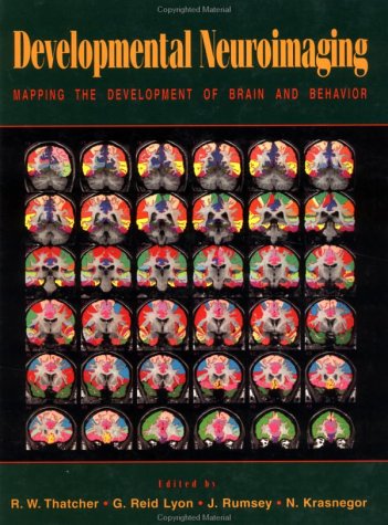 Developmental Neuroimaging: Mapping the Development of Brain and Behavior