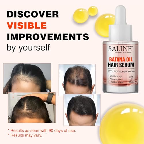 Image of SALINE Batana Redensyl Hair Growth Serum with Biotin, 3% Redensyl, 4% Anagain, 2% Rice Water, and Plant Keratin 30ml - Hair Growth Serum for Men & Women