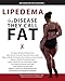 Lipedema - The Disease They Call FAT: An Overview for Clinicians