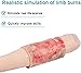 Burn Wound Model, Wearable Silicone Limb Burns Simulator, 2-3 Degree Limb Burns Training Module for Care, Medical Teaching Demonstration.