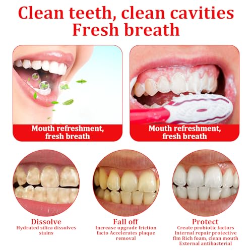 Sp-6 Zahnpasta,Sp6 Zahnpasta,120g Probiotische Zahnpasta,Sp-6 Probiotic Zahnpasta,Sp 6 Probiotische Zahnpasta Zur FleckenentfernungZur Entfernung Von Zahnaufhe – Bild 5