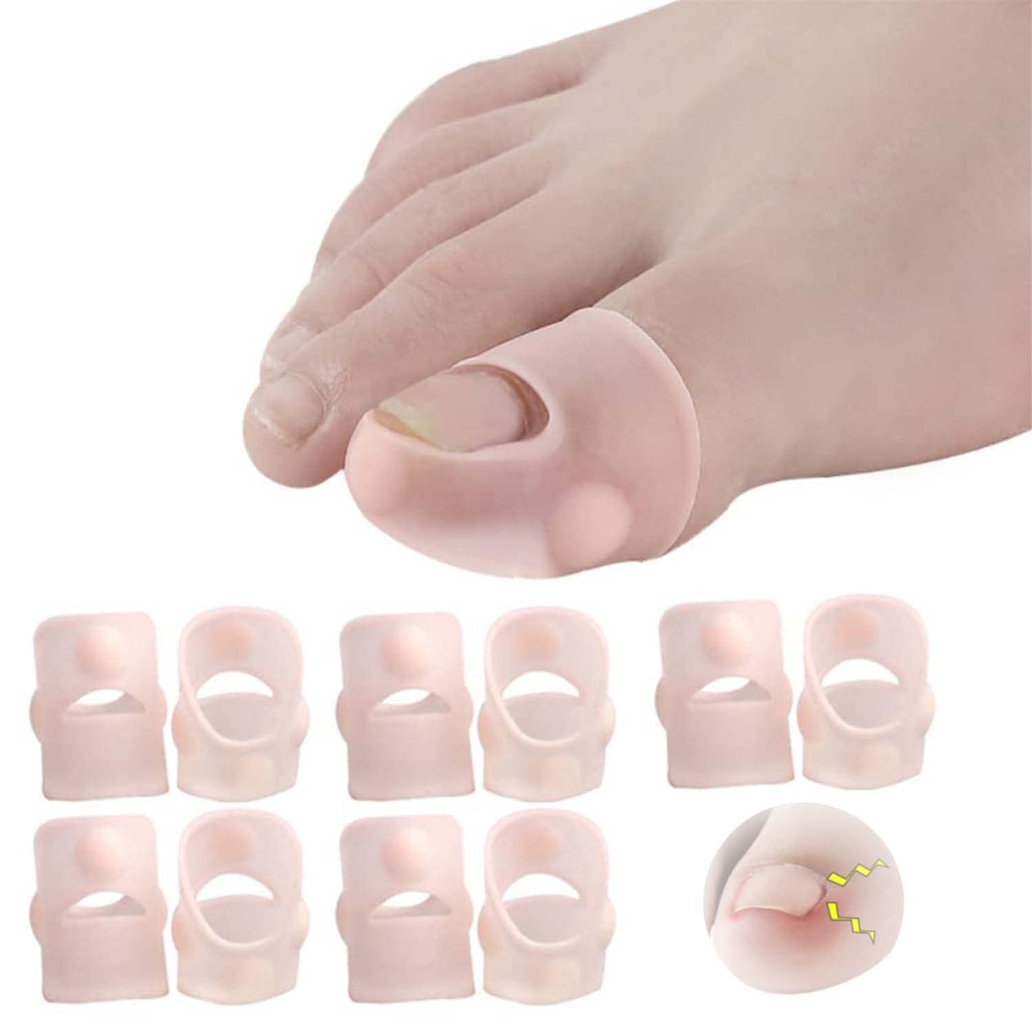 SYOSI Elastic Silicone Ingrown Toenail Correction Sleeves, Ingrown Toenail Corrector Ingrown Toenail Lifter, Big Toe Sleeves Foot Care Toe Protector Paronychia Treatment Pedicure Tool Set, 5 Pairs