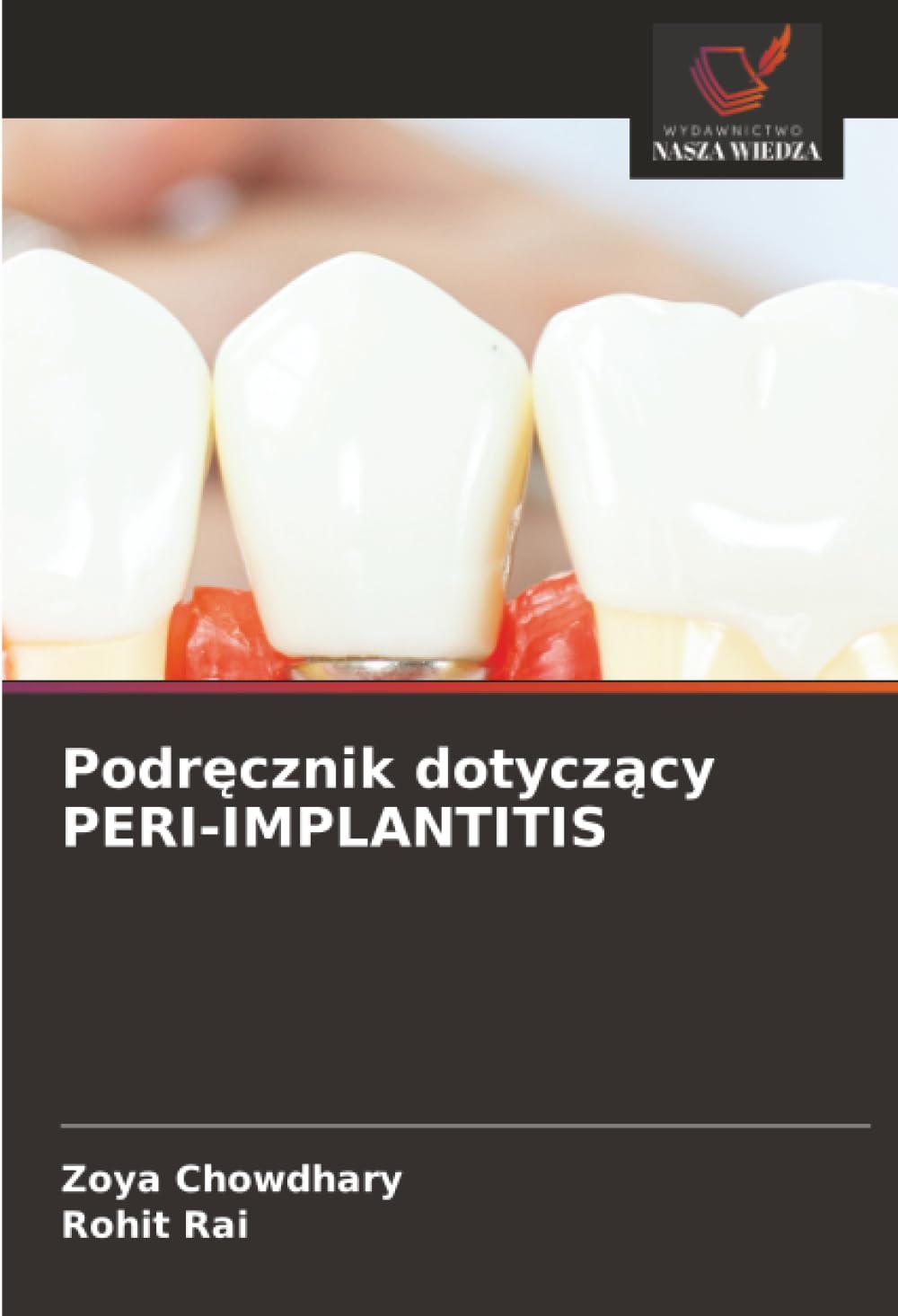 Podręcznik dotyczący PERI-IMPLANTITIS