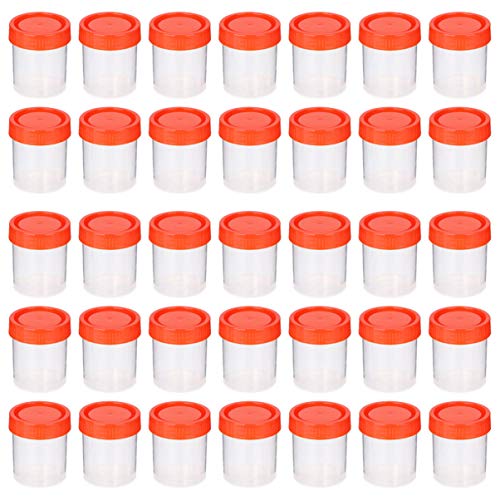 Contenedores de Recogida de Muestras