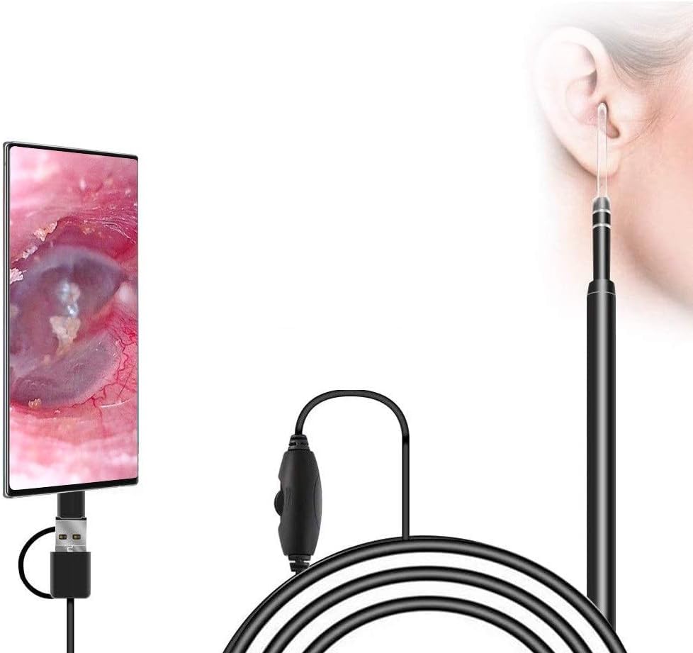 Otoscope USB 3-en-1 avec caméra endoscopique HD 5.5mm pour nettoyage d'oreilles