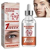 KOAHDE Milia Removal Face Serums,Milia Spot Treatment,Milia Treatment Spot Remover for Face,Speedy Milia Remover,Milia Spot Ruduce Face Serums,Dark Spot Remover Face Serum,Milia Removal Spot Care