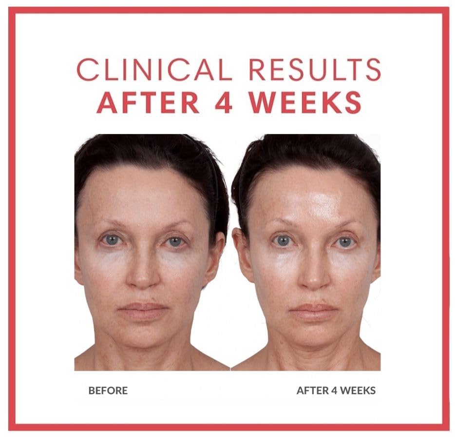 Consult Beaute Volumagen - Collagen Anti-Aging Serum for the Face - Hyaluronic Acid - Skin Nourishing & Plumping - Hydrates and Temporarily Fills for Smoother, Bouncy Skin - 2 Oz. Duo (2 Piece Set) - Image 4