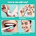 Teeth Whitening Gel Refill, 8 Packs, 35% Carbamide Peroxide Whitening Gel for Trays, Profesional Teeth Bleaching Gel for Fast Result, Work with Teeth Whitening Kit, IMOSTY Whitening Gel (8 x 3ml)