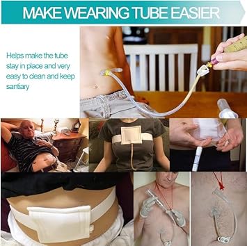 Breathable G Tube Holder Belt Large Square Sponge Feeding Tube Pouch for Gastrostomy J Peg Peritoneal Dialysis PD Peritoneal Dialysis Catheter Accessories Women Men Beige Medium