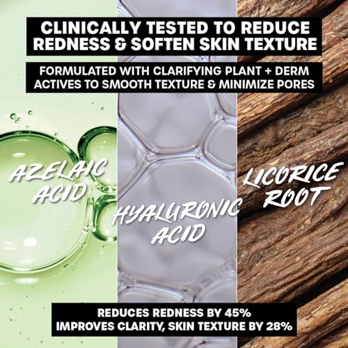 Thayers Let's Be Clear Water Face Cream, Moisturizer with Azelaic Acid and Hyaluronic Acid - Image 4