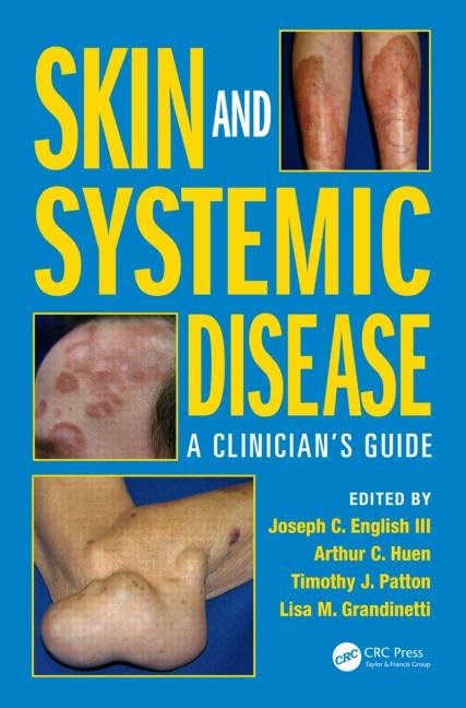 健康・医学 SKIN AND SYSTEMIC DISEASE Buy Skin and Systemic Disease: A Clinician's Guide Book Online at