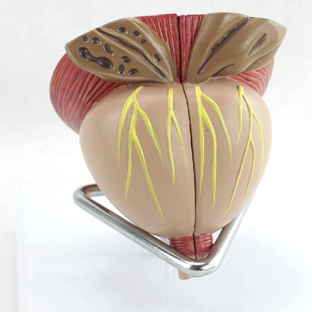 Teaching Model Anatomy Model, Assembly Educational Model Prostate Anatomical Model Zoom 2X Male Prostate Model Detachable 4 Parts Human Organ Anatomical Model for Study Dislay for School,Edu