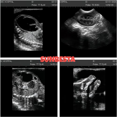 ultrasound machine pro 1669