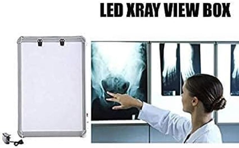 KASHSURGX Ray LED Illuminator Wall Mounting View Box Dentist Very Bright LED Viewing Area 14X17_Set 3