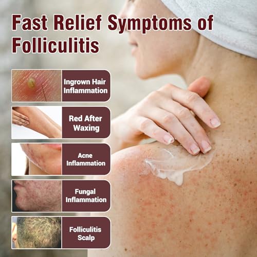Image of Folliculitis Treatment Cream, 3.52oz | Fast-Acting Relief for Scalp, Face & Body, Soothes Itching, Redness & Inflammation, Natural Colloidal Oatmeal Formula