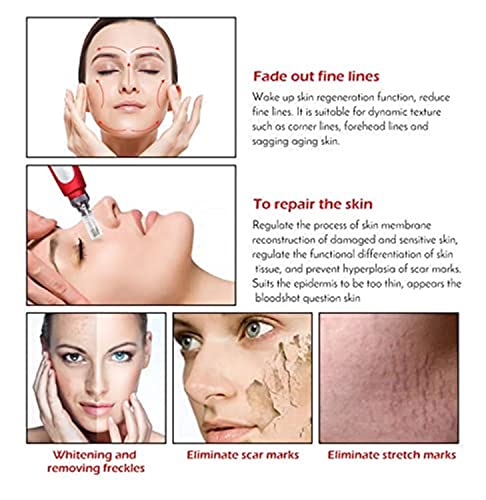 Concepta Therapy MyM Derma Pen with 2 Extra 12 Needles Cartridges Derma Pen | Mesopen for Anti Aging | Skin Facial Care | Skin Rejuvenation - Image 6