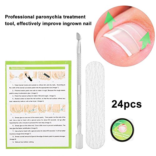 Nail Correction Patches,Professional Nail Correction Sticker,Pedicure Paronychia Recover Ingrown Toe Nail Manicure Clipper Fixer Special Pedicure Tools Foot CareTool Kit
