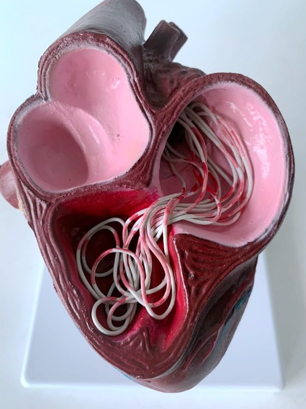 Medical Science Dog Heart Pathology Model Canine Heart Dog Heartworm Anatomical Model