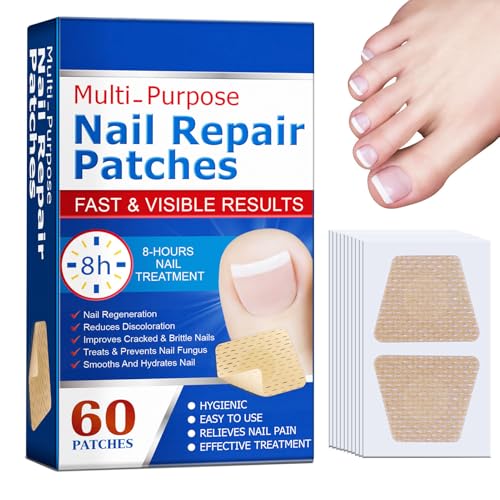 60 Parches Para Uñas De Los Pies | Parches Reparadores De Uñas | Parche Corrector De Uñas De Los Pies | Parches Correctores Para Tratamiento De Uñas | Para Uñas De Pies Y Manos