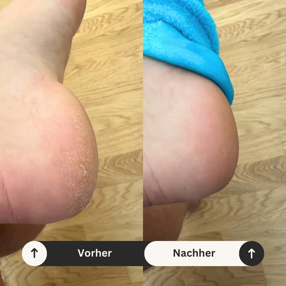 Nuwelo's Hydra Fersen-Socken für Hornhaut, 2x Weiche Gel-Fersensocken, Moisturizing Flauschige Socks (1 Paar)
