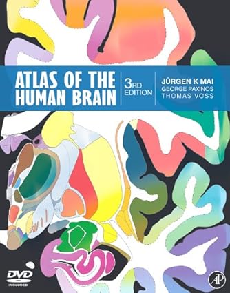Atlas of the Human Brain: 9780123736031: Medicine & Health Science ...