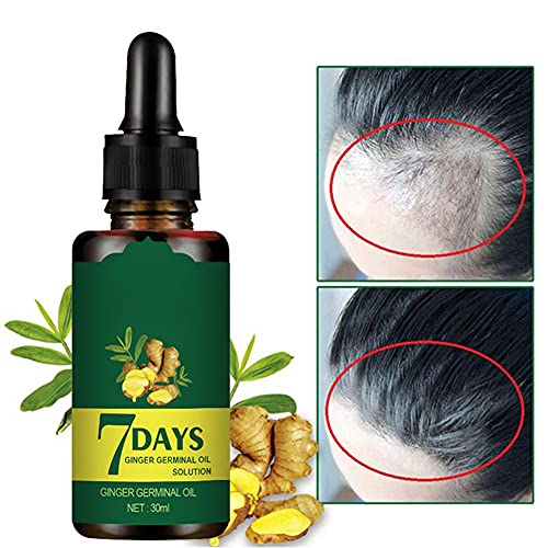 Panarciss Hair Regrow 7 Day -Ginger Germinal Oil for Hair Loss Treatment -Ginger Serum Essential Oil for Thicker Longer Fuller Healthier Hair -Thinning Treatment Hair Growth Oil for Men and Women