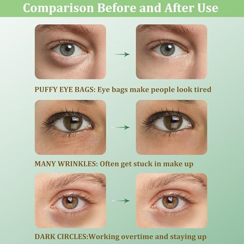 Under Eye Patches, Collagen Under Eye Mask, Dark Circles Under Eye Treatment, Puffy Eyes Bags Under Eyes Removal, Anti-Aging - Image 3