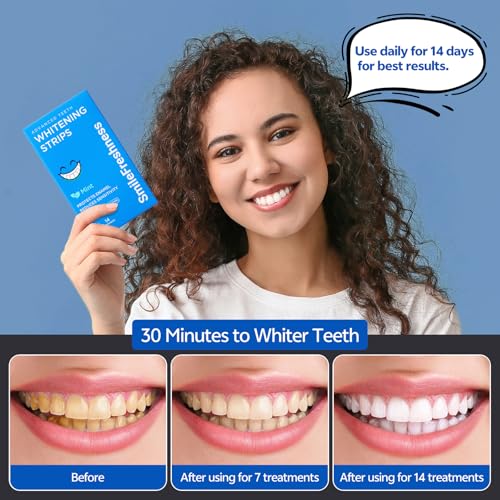 Image of Teeth Whitening Strips, 14-Day Treatments Clinically Proven for Visible & Affordable Teeth Whitening, Enamel Care Whitening, Reduced Sensitivity Formula, Mint.