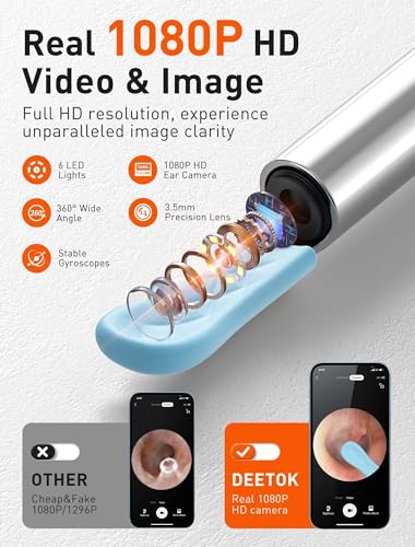 Image of Ear Wax Removal Tool Camera - Ear Cleaner with 1080P HD Camera, FSA HSA Store Eligible, Otoscope with Light, Earwax Removal Kit with Replacement Tips for iPhone, iPad, Android Phones (Gray)