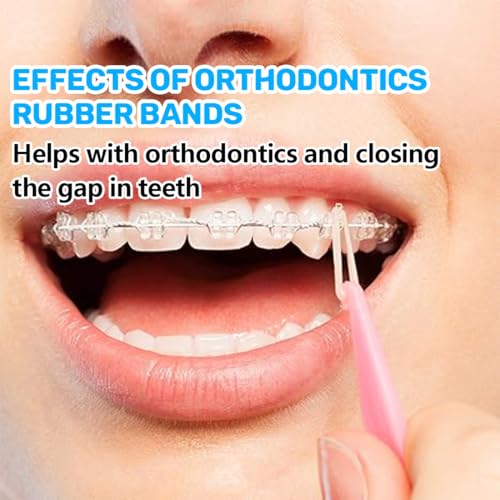 Orthodontic Rubber Bands, Pack of 300 Elastic Teeth Elastic Bands with 5 Placers for Braces, 5/16 Inch Orthodontic Elastics for Braces Dreadlocks Tooth Gap zahnspangengummis