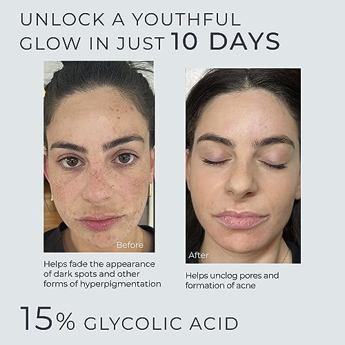 Instaskincare Glycolic Acid Serum For Face 15% Strength thumb #1
