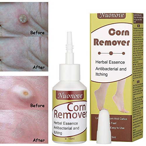 Corn Remover, Corn Removal, Corn Remover Liquid, Foot Corn Removal, Corn Callus Remover, 15ml